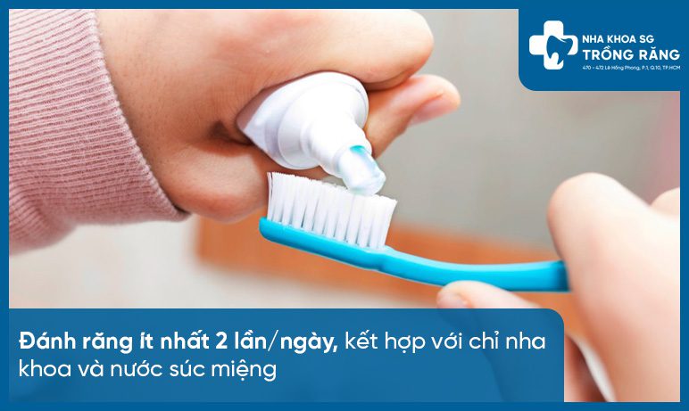 Cham soc rang sau khi nieng dung cach Chăm sóc răng sau khi niềng đúng cách