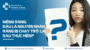 Nguyên nhân niềng răng bị chạy lại