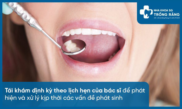 Tai kham sau nieng rang de tranh bi chay lai Tái khám sau niềng răng để tránh bị chạy lại