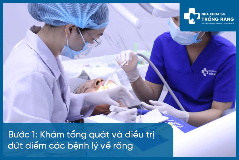 Bước 1 làm hàm răng giả tháo lắp