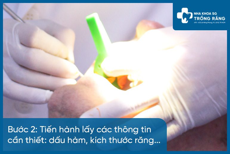 Bước 2 làm hàm răng giả tháo lắp