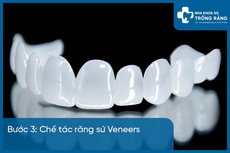 Buoc 3 dan rang su veneer