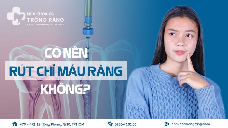 Có nên rút chỉ máu răng không