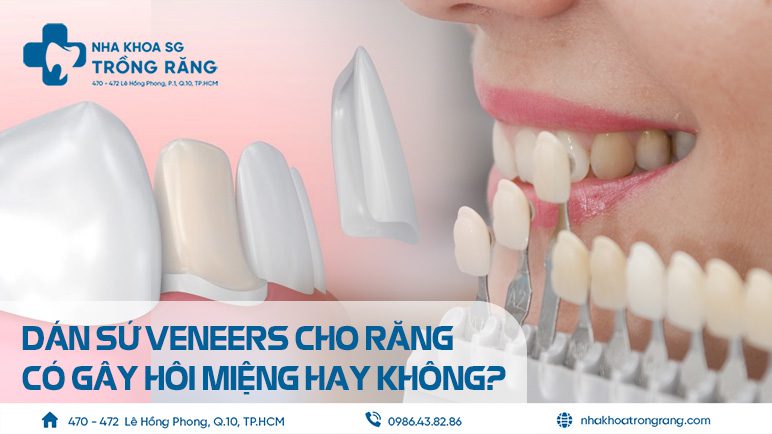 Dán răng sứ bị hôi miệng