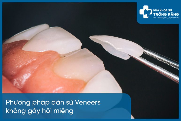 Dán răng sứ có bị hôi miệng không