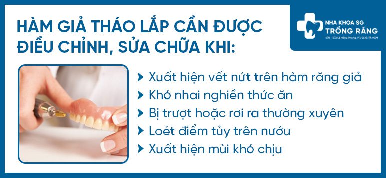 Dấu hiệu hàm giả tháo lắp cần được thay mới