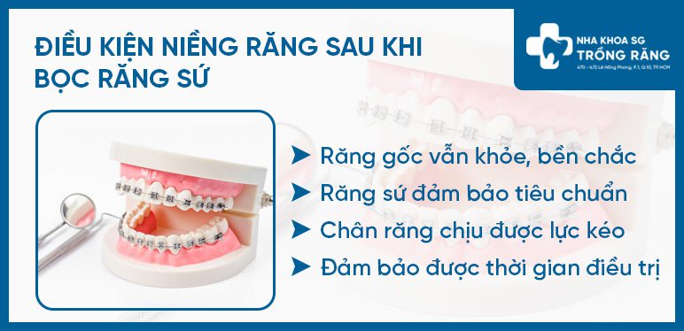 Điều kiện niềng răng khi răng đã bọc sứ