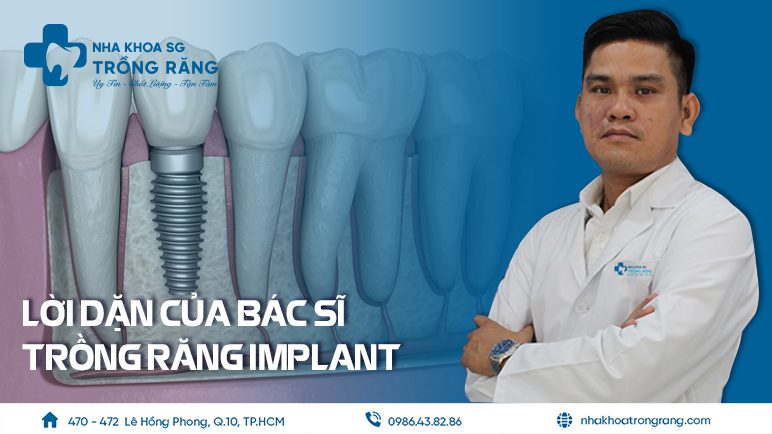 Lời dặn của bác sĩ trồng răng implant giỏi
