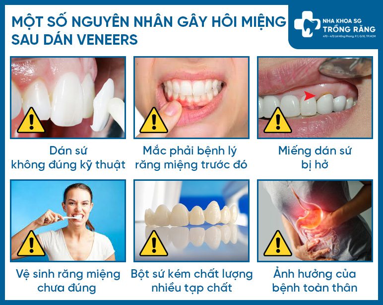 Lý do dán răng sứ bị hôi miệng