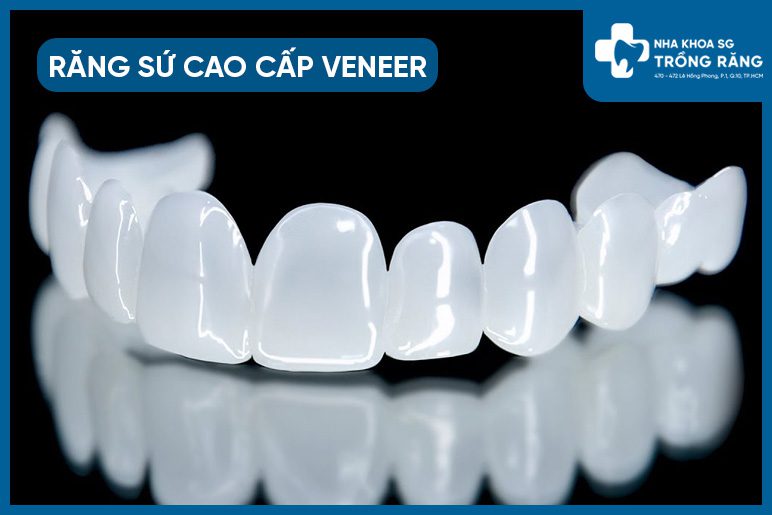 Mặt dán sứ Veneer