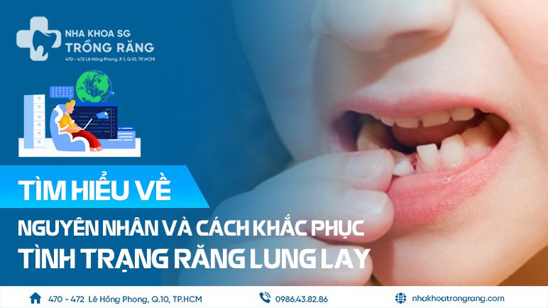 Nguyên nhân và cách khắc phục răng lung lay