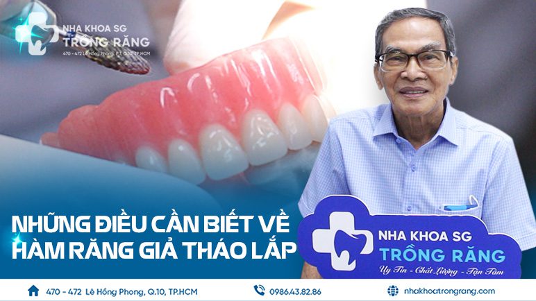 Những điều cần biết về hàm răng giả tháo lắp