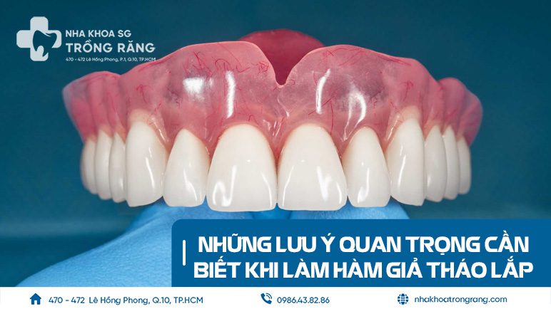 Những lưu ý khi làm hàm giả tháo lắp