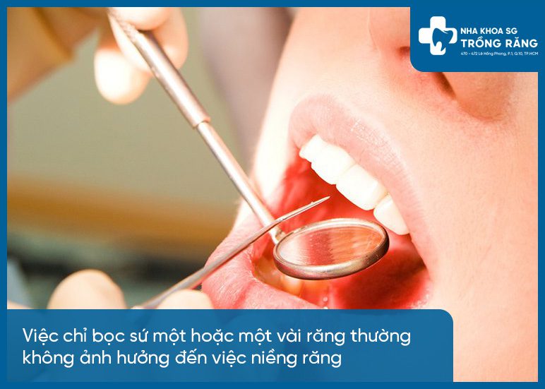 Răng đã bọc sứ không ảnh hưởng niềng răng