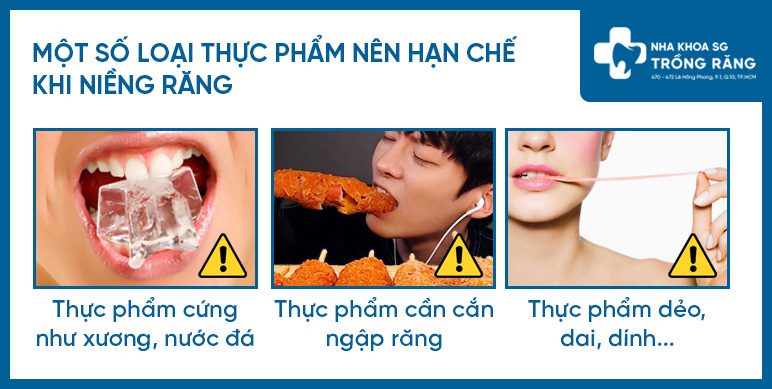Thực phẩm nên hạn chế khi niềng răng