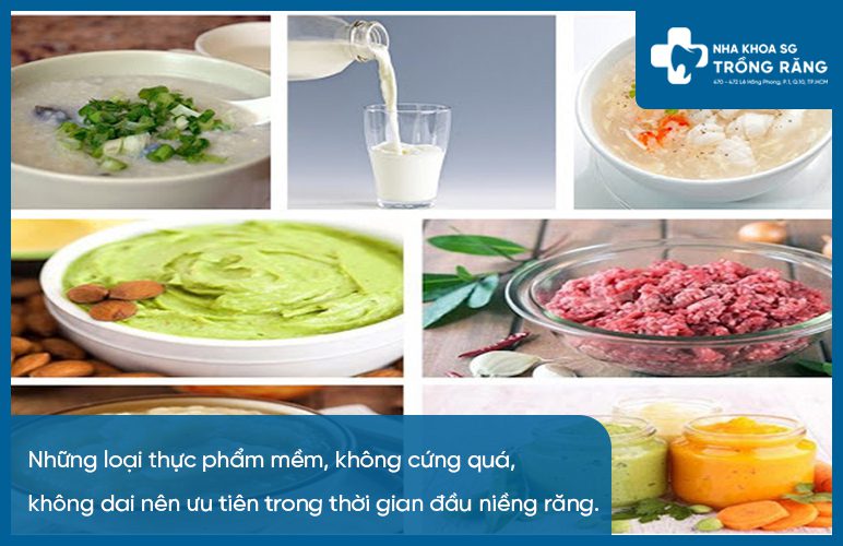 Thực phẩm nên ưu tiên khi niềng răng