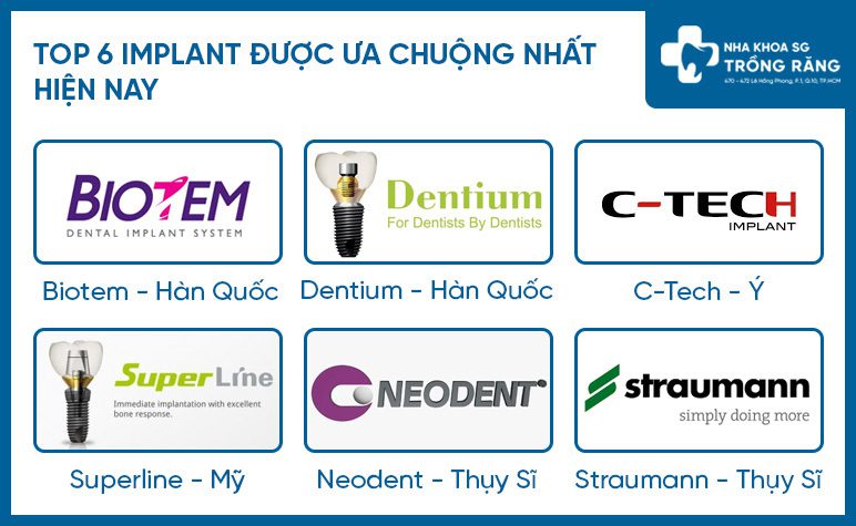 Các loại trụ implant phổ biến