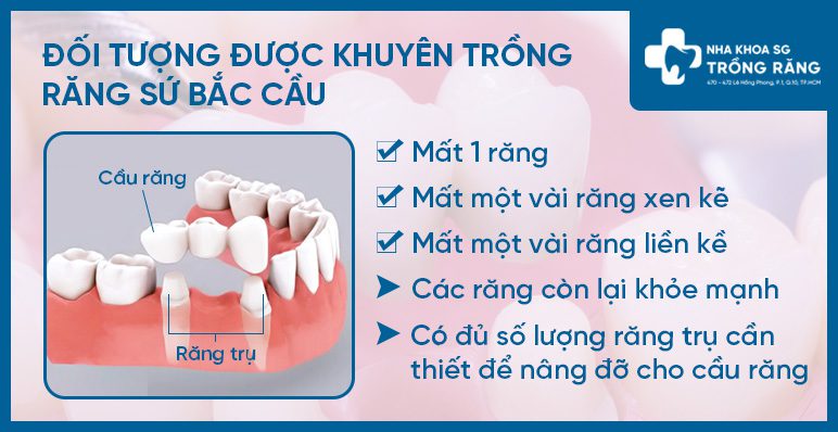 các loại răng giả