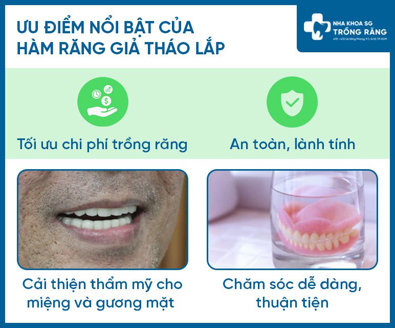 Ưu điểm của răng nhựa giả tự nhiên