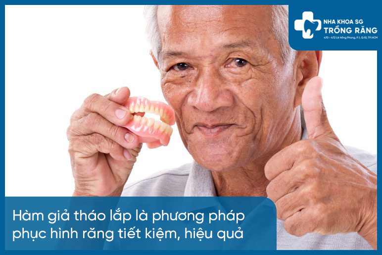Ưu điểm sử dụng hàm răng giả tháo lắp