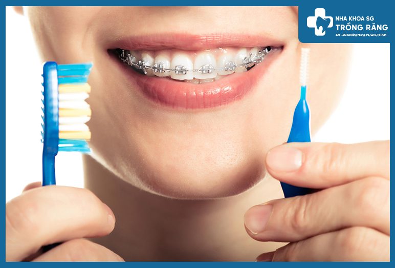 bộ dụng cụ chăm sóc răng miệng khi niềng răng