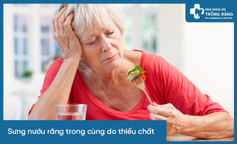 sưng nướu răng trong cùng do thiếu chất
