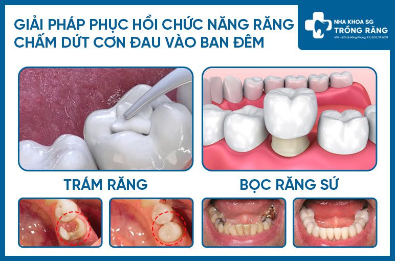 Các phương pháp điều trị đau nhức răng vào ban đêm Các phương pháp điều trị đau nhức răng vào ban đêm