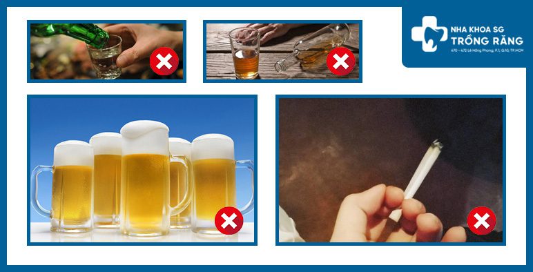 Hạn chế thực phẩm rượu bia sau khi trồng implant
