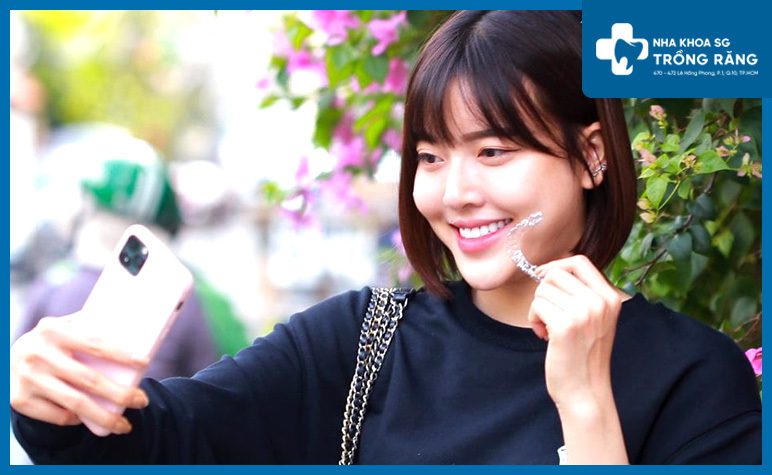 Hình ảnh niềng răng thưa trong suốt