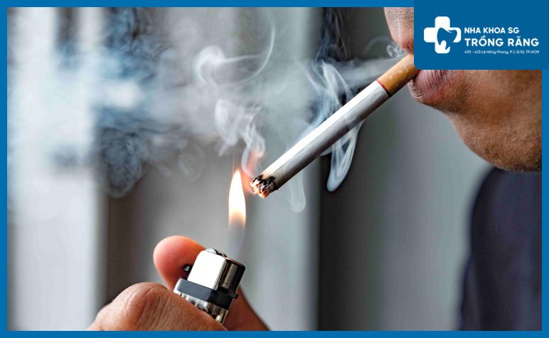 Hut thuoc lam xin mau rang sau nhổ răng khôn có hút thuốc được không?