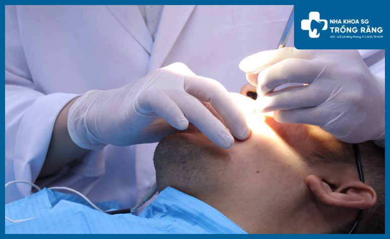 Khám răng đau nhức ở đâu