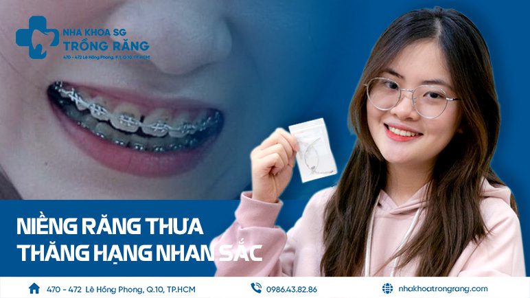 Niềng răng thưa có đau không