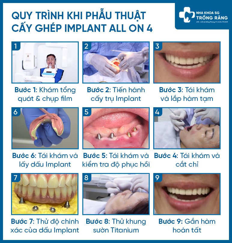 trồng răng implant tphcm uy tín