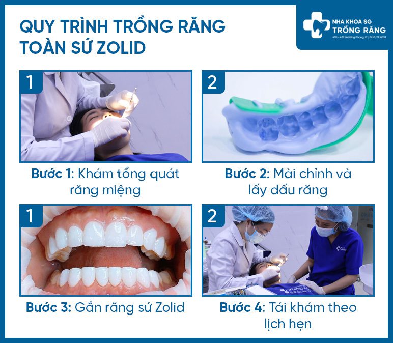 Quy trình trồng răng sứ Zolid