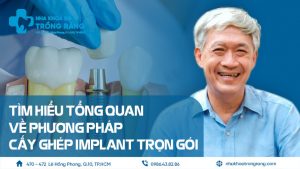 Tổng quan cấy ghép implant