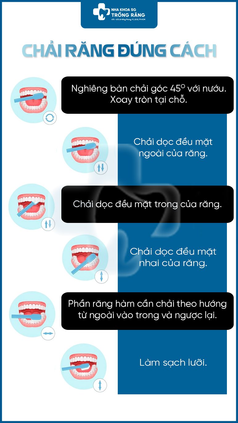 Hướng dẫn chải răng đúng cách để không sâu răng