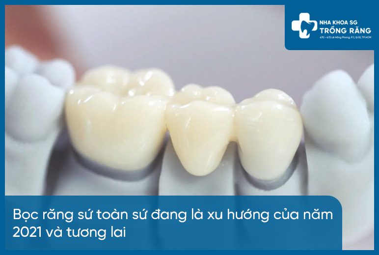 Xu hướng bọc răng sứ