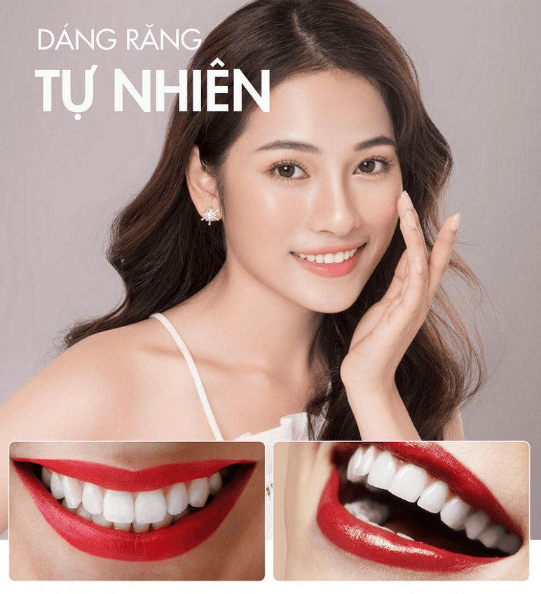 sửa mũi làm răng sứ