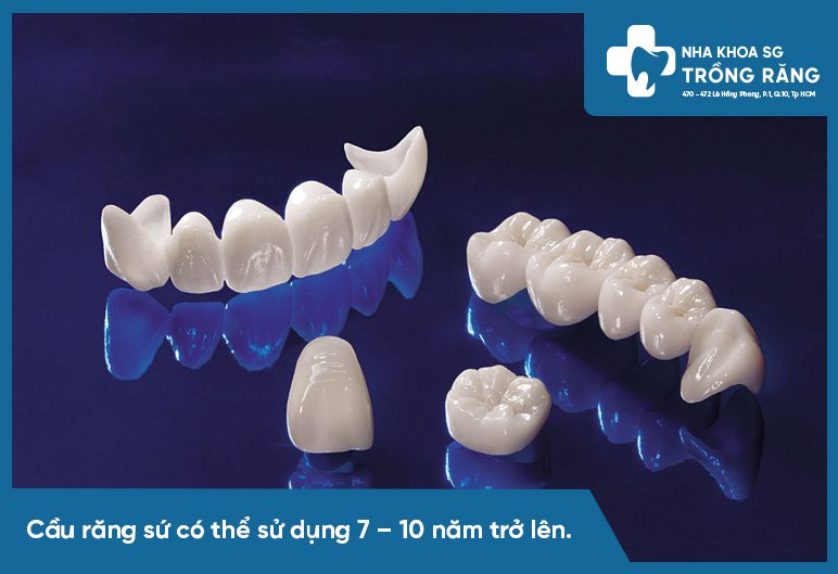 cầu răng sứ sử dụng bao lâu