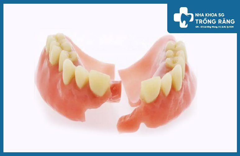Hướng dẫn cách dán răng giả bị rớt, bị gãy