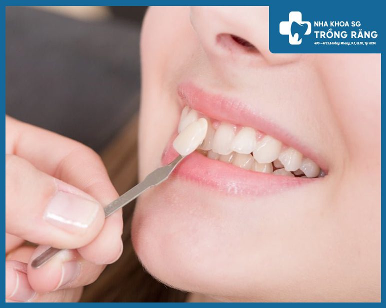 Hướng dẫn cách dán răng giả bị rớt, bị gãy