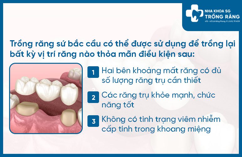 làm cầu răng sứ có tốt không