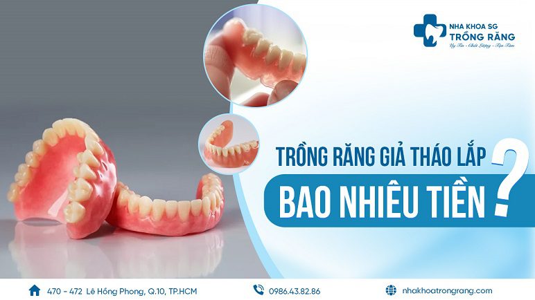 làm răng giả tháo lắp bao nhiêu tiền