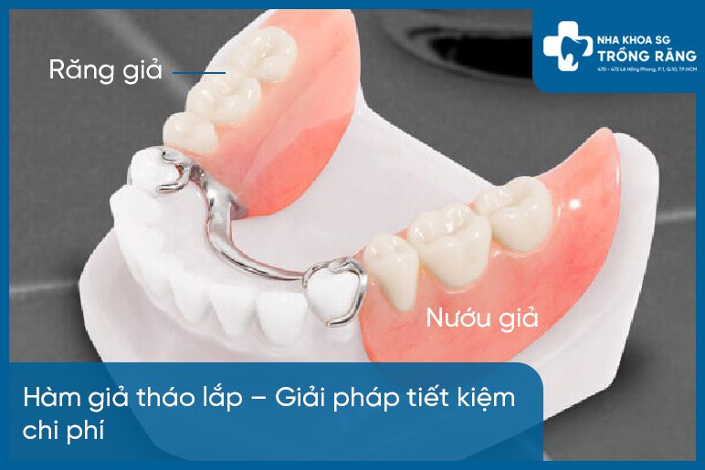 làm răng giả tháo lắp chi phí bao nhiêu