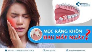 mọc răng khôn đau mấy ngày