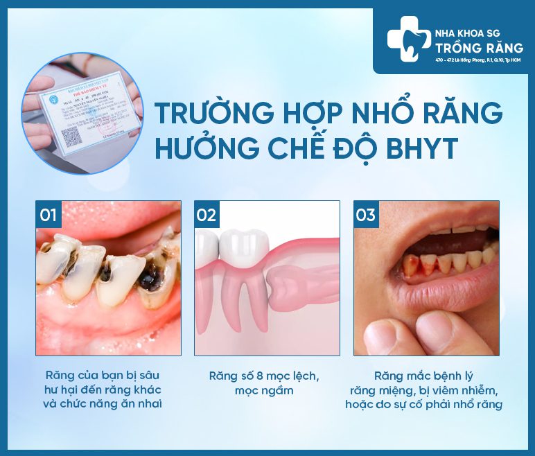 nhổ răng bảo hiểm y tế