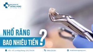 nhổ răng khôn bao nhiêu tiền