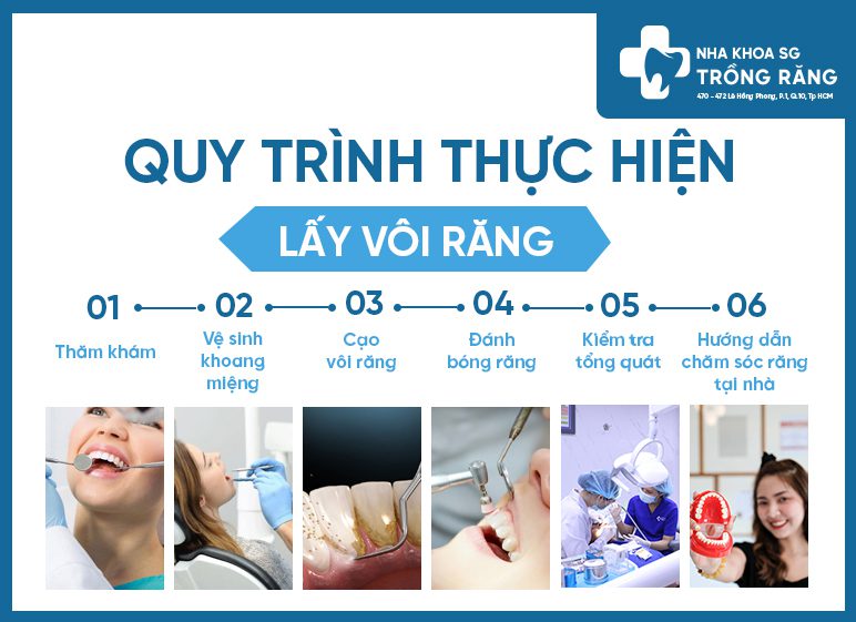 quy trình lấy vôi răng quy trình lấy vôi răng