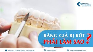 răng giả bị rớt thì phải làm sao