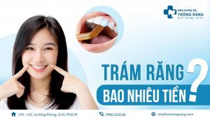 trám răng bao nhiêu tiền